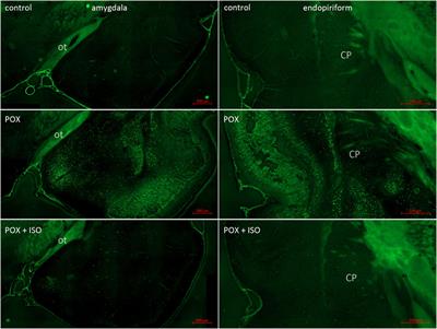 Isoflurane-lipid emulsion injection as an anticonvulsant and neuroprotectant treatment for nerve agent exposure